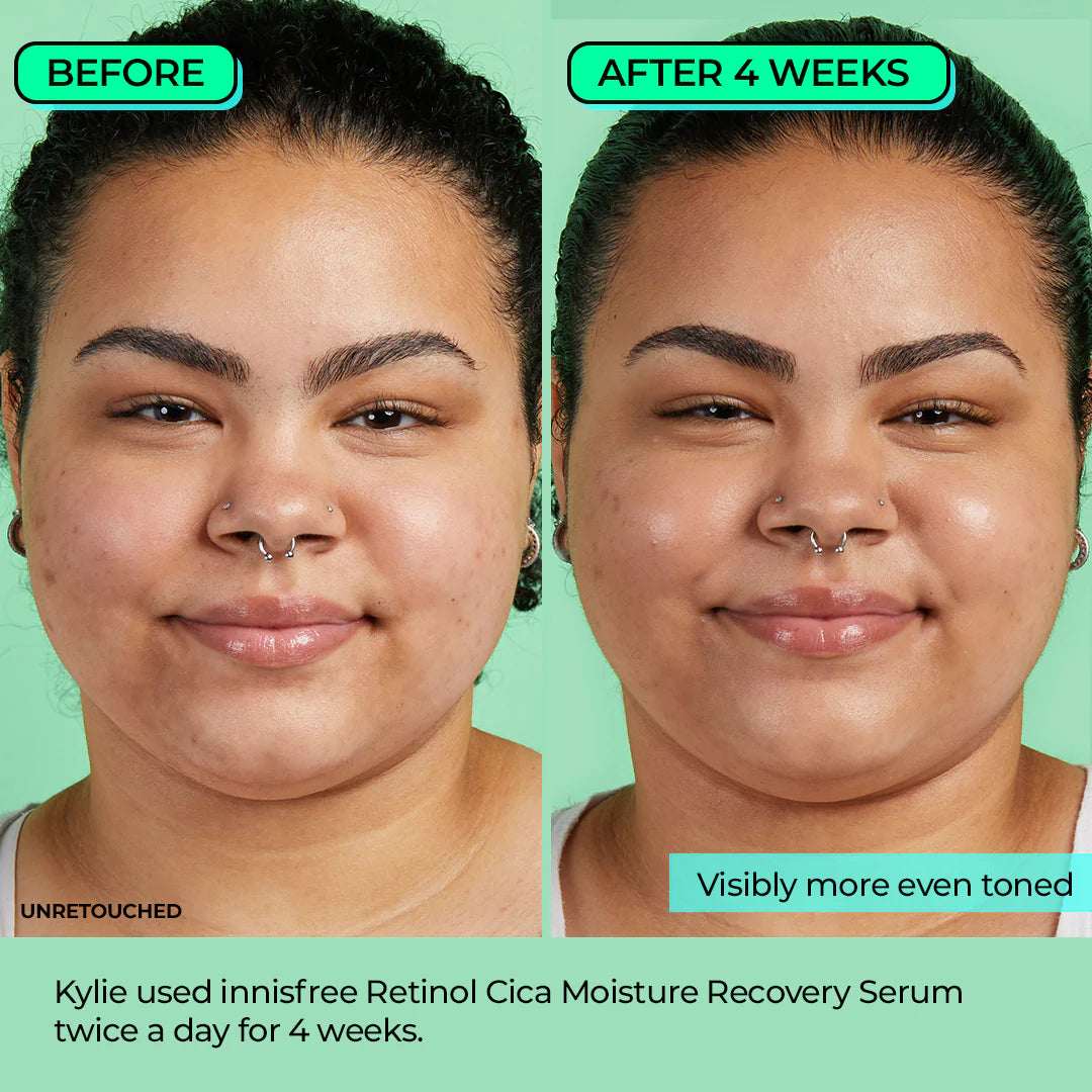 Retinol Cica Moisture Recovery Serum