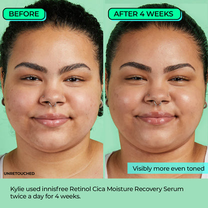 Retinol Cica Moisture Recovery Serum